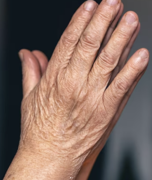 Hand surgery at Baku Hand Center